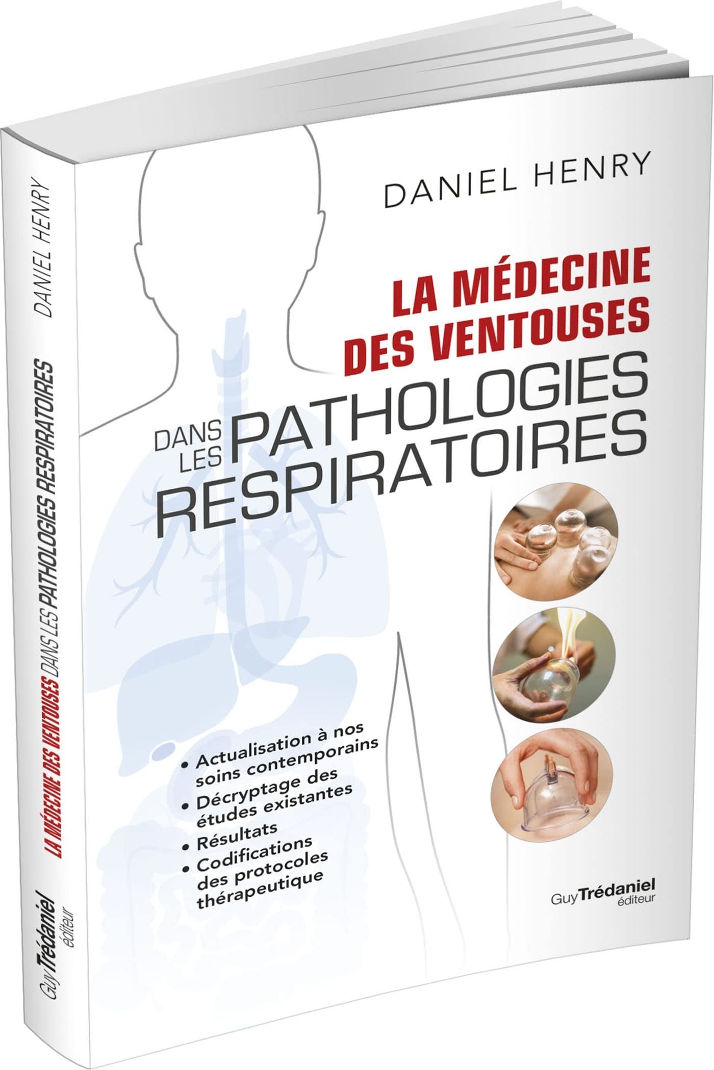 La médecine des ventouses dans les pathologies respiratoires - La